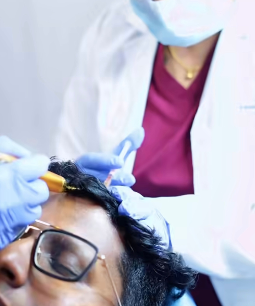 PRP hair treatment results showing improved hair density and reduced hair fall in Bangalore clinic